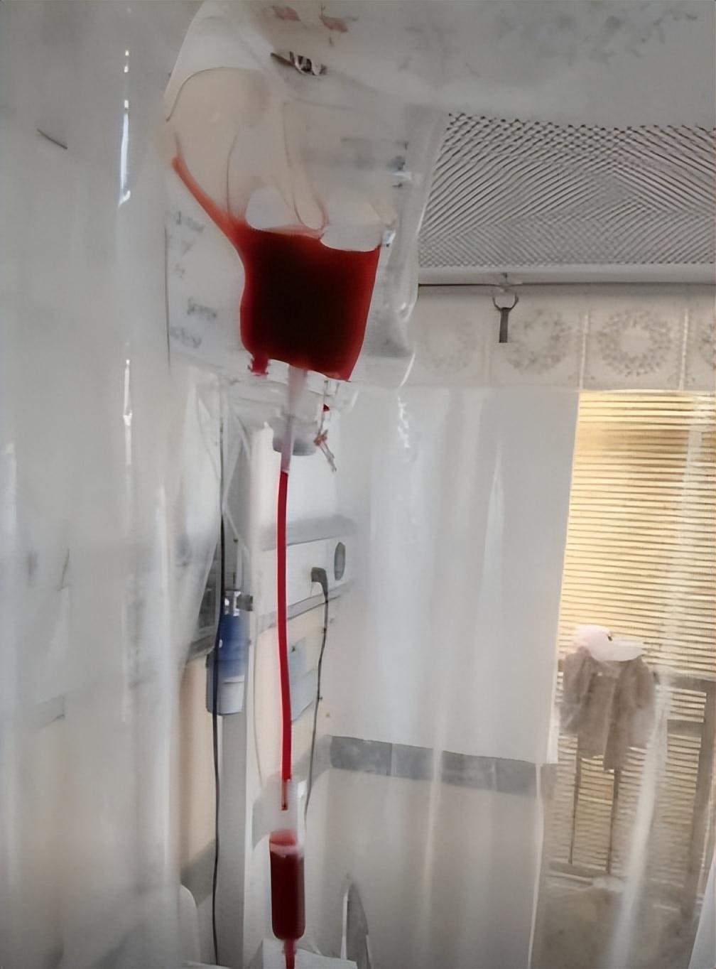 ‘澳门新银河在线登录’实现零突破！开州自体造血干细胞移植患者顺利出院(图1)