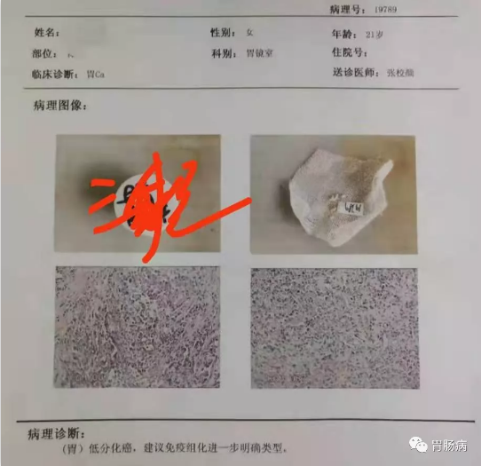 重庆肿瘤专家:过半患者都爱这两种食物